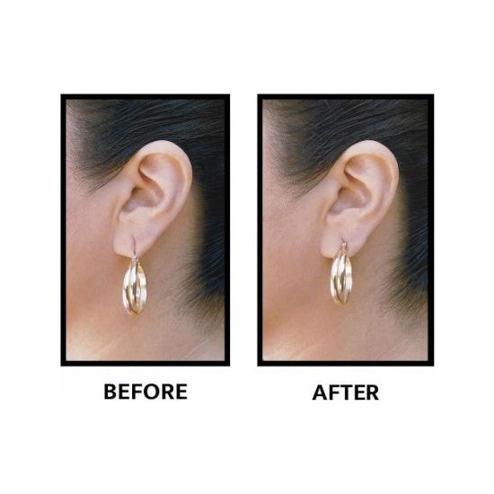 Lobe Wonder Ear Lobe Support Patches - Rhinestone Gal