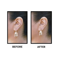 Lobe Wonder Ear Lobe Support Patches - Rhinestone Gal