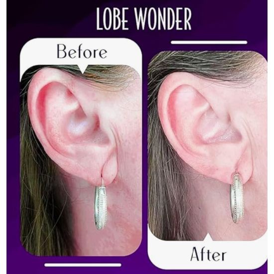 Lobe Wonder Invisible Earring Support Patches (60 Pack)